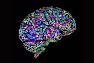 neuroplasticité